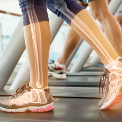 Image of feet walking on a treadmill