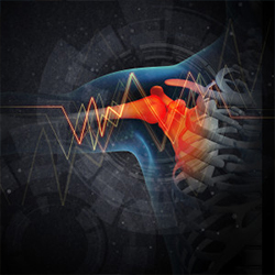 Image of a shoulder x-ray